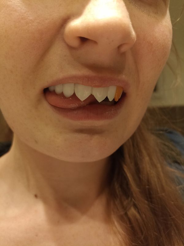 Naya_mitsui – Création angel dust 