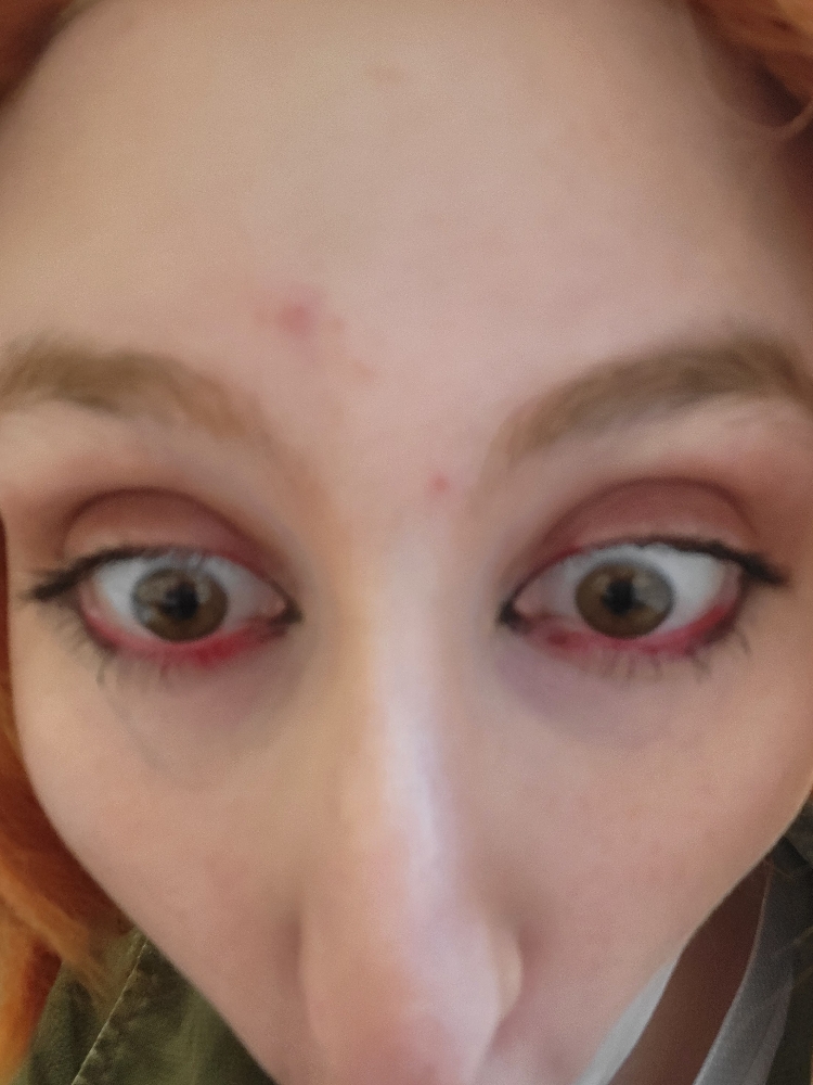 Chaotic Young Chuuya - Photo 11